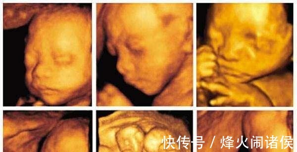 脐带|四维彩超那么贵, 不懂这些就白做了 3分钟让读懂报告单!