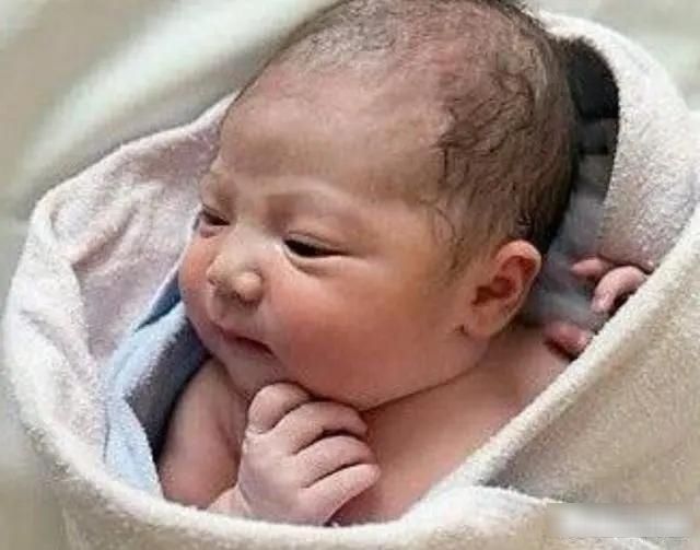 瘀痕|宝宝出生后太丑,妈妈眼角藏泪花抢眼,不用退货等着逆袭吧!