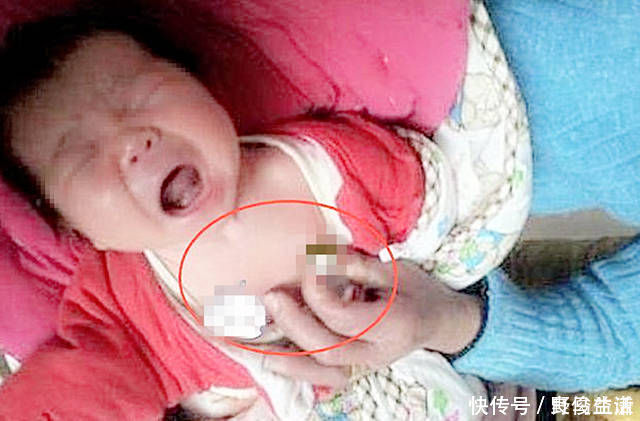 王女士|新生儿患上败血症,只因妈妈这个小动作,网友怎么狠心下得了手
