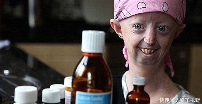 疼痛|七岁宝宝得了这种怪病,却不哭不闹帮妈妈照顾弟妹,疼痛时想睡觉