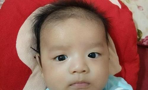 营养均衡|宝宝头发为啥总是竖着长?这三种情况对照一下,早发现早改善!