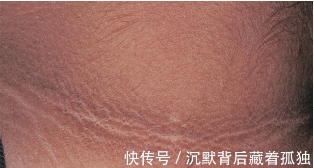 脖子|9岁小女孩脖颈发黑洗不掉,经医院检查后,医生的话却让家长笑了