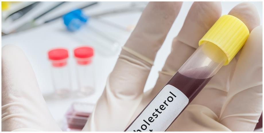 动脉硬化|血脂高不高,看脸就知道,若没有这3个症状,恭喜血脂控制得不错