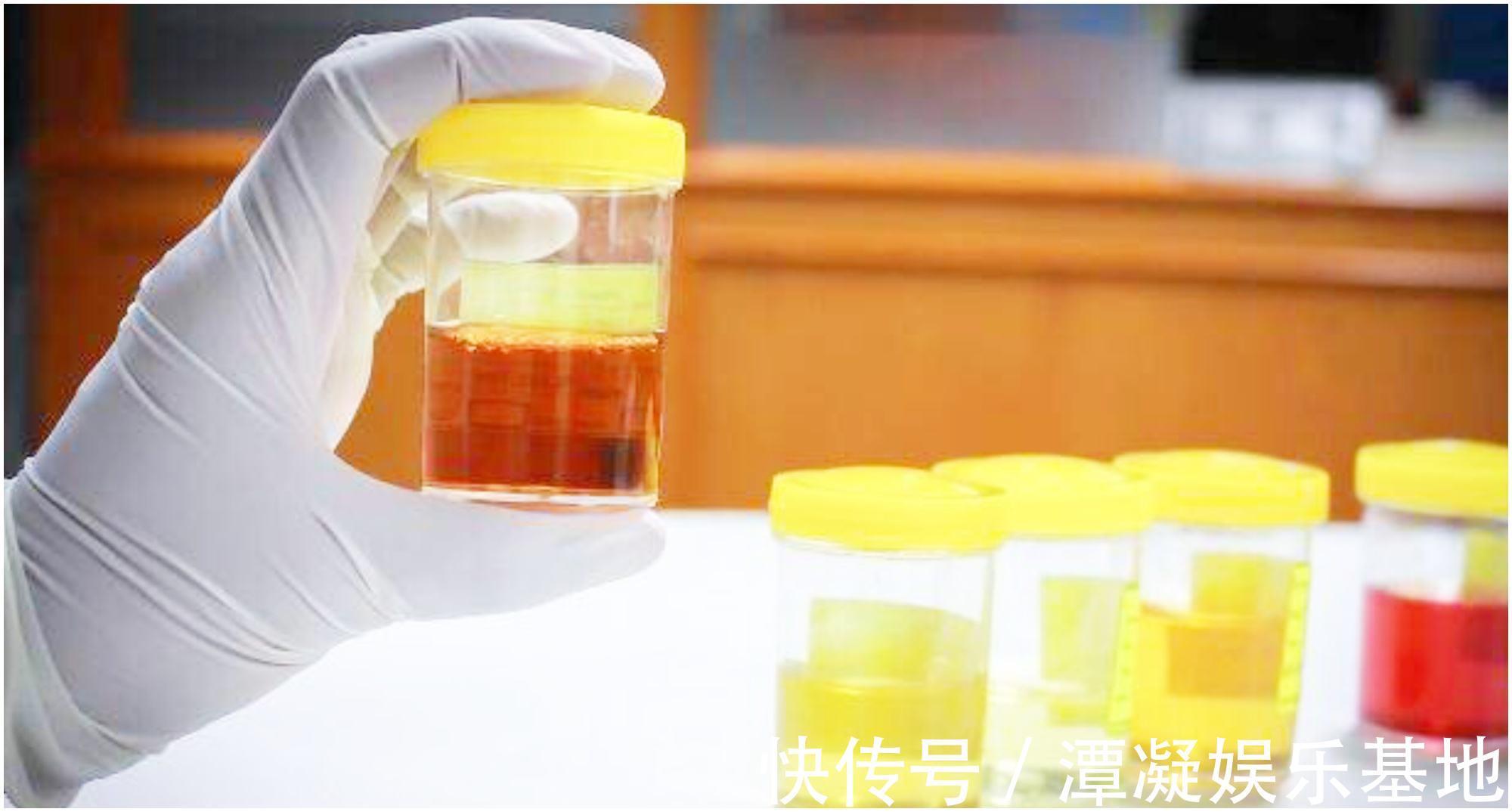 裸燕麦|天然“降糖冠军”找到了,不是苦瓜,平时敞开喝,糖尿病不告而别