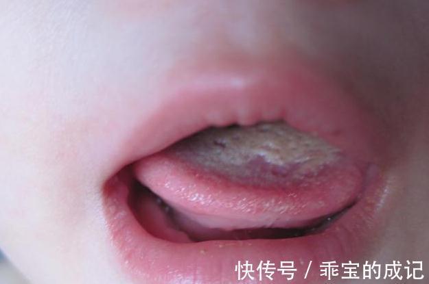 积食|3个方子是脾胃的“保护伞”,日常不妨孩子吃一点,可消积食