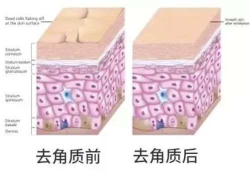 角质真能搓下来？智商税别交！