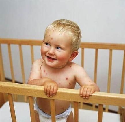 家长|白血病不是突如其来,不论男女,孩子一旦出现“3迹象”,家长别大意!