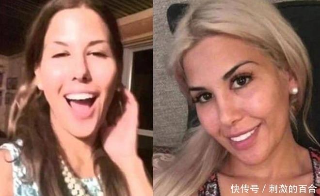 整容|女子花重金整容,一年经历13次整容手术,整容前后判若两人