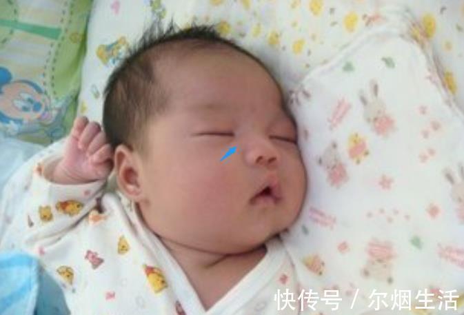 郑嘉颖|宝宝的鼻梁何时“定型”?塌鼻梁的娃想“逆袭”,要满足哪些条件