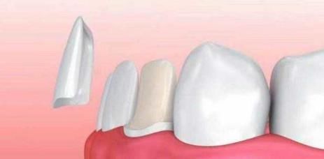 强大|一个无比强大的方子，仅3味药，把痰湿彻底祛除，通体安泰