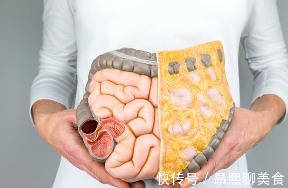 柯坪芜菁|52岁女子肠癌晚期!医生肠癌曾经给你3次机会,你本该抓得住