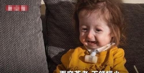 疾病|全球首例!2岁女童却有80岁的脸,网友:希望能像本杰明巴顿一样
