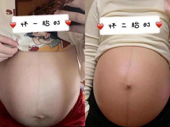 这些事|怀了两胎都没长妊娠纹？孕期三阶段做好这些事，花肚皮远离你