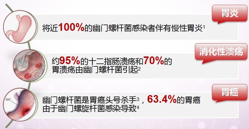 hp|感染幽门螺杆菌会不会得胃癌？关于幽门螺杆菌，这是一篇最全的科普！