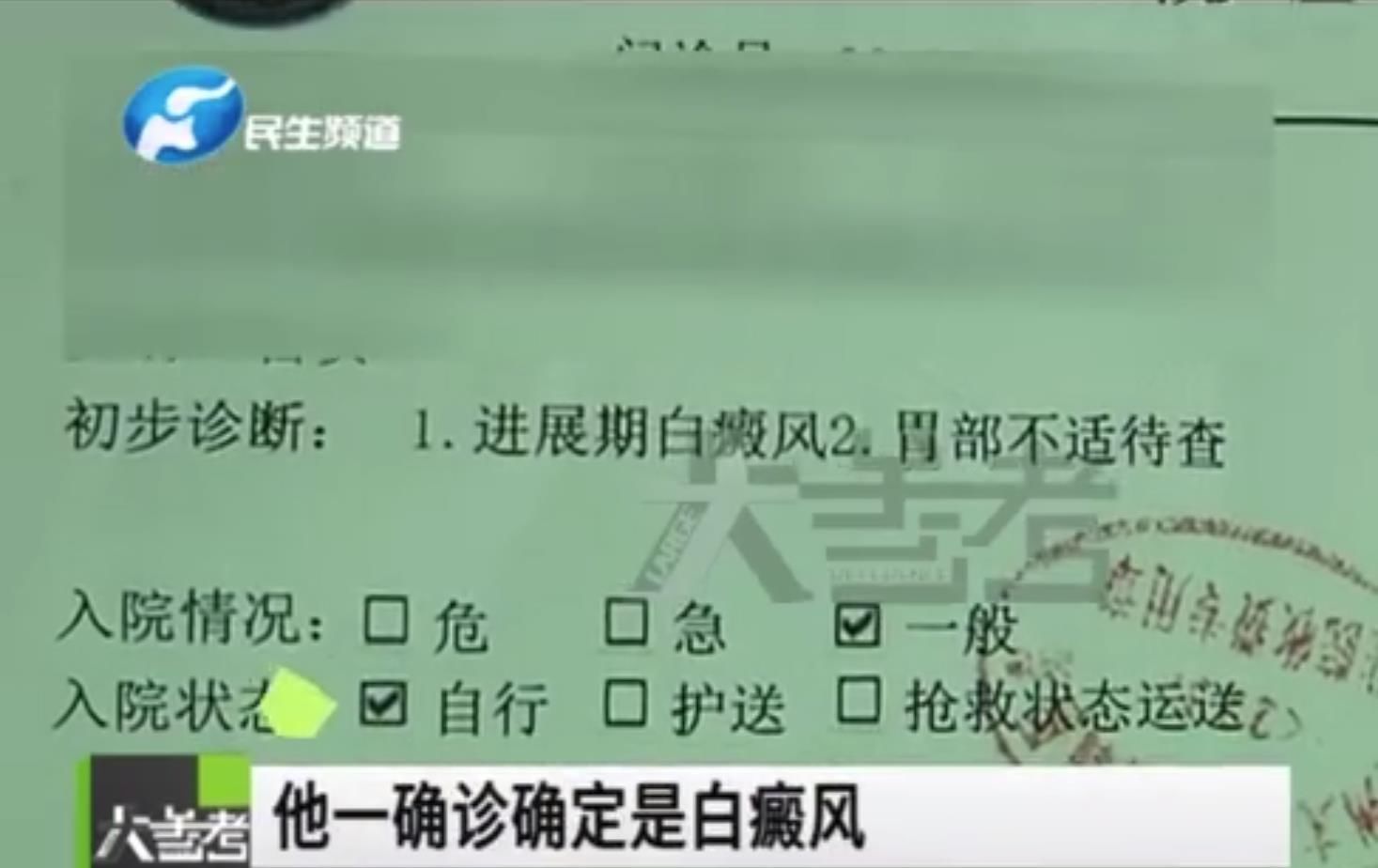 白眉大侠|女子割双眼皮后变“白眉大侠”？怀疑手术引起白癜风