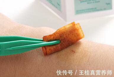 试纸|测量血糖5步走，做对了血糖数值准确，做错了后果不好说