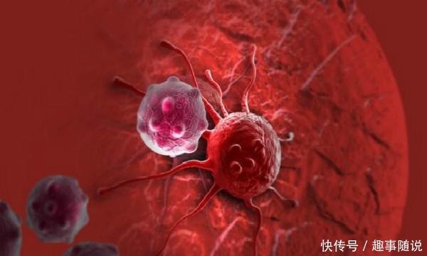 死亡|同样是胃癌,为什么有的人胃癌术后没复发,有的却因复发死亡?