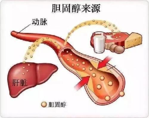 服用阿托伐他汀，为什么要补充辅酶Q10？医生是这么说的