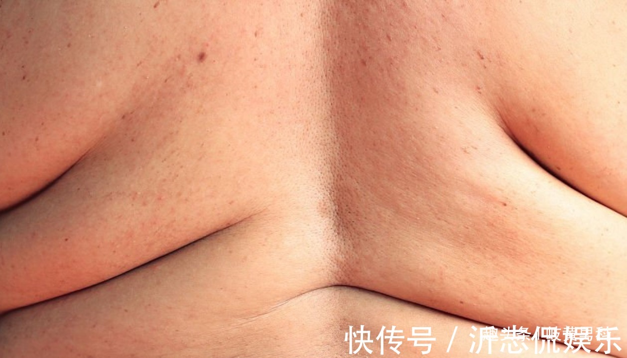 危害|肥胖的危害,远比你想的要重,莫让肥胖成为男人永远的痛!