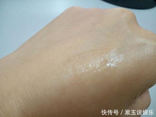 丘疹|长了脂肪粒怎么办不能用手抠也不能抓挠,教你真正的去除办法