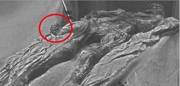 光绪皇帝|光绪墓被盗多次，考古队发掘古墓时，却从他双手间发现巨大秘密