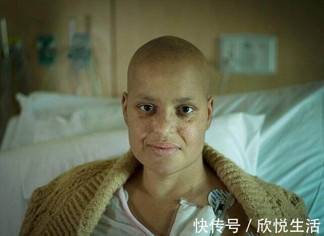 癌症患者|36岁女子肺癌晚期，一年后癌细胞越来越少，医生多亏了它们