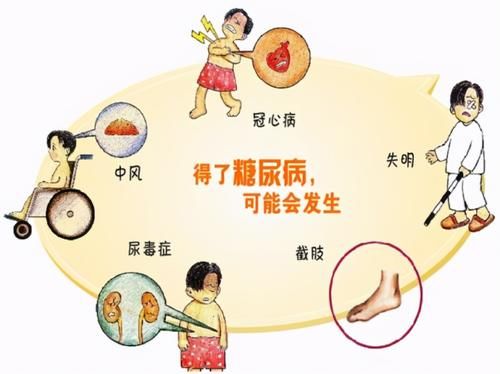 手术治疗|谁说糖尿病不能根治？这类人真的有可能被治愈