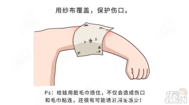 坏家伙|偏方治烫伤,6月娃不幸离世!孩子烫伤后,牢记5个字,能救命