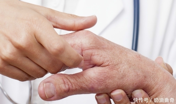 还在为“关节炎”而烦恼?老中医奉献2个小妙招,天下人的福音!