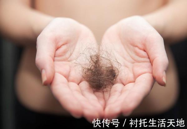 双氢睾酮|脱发自救指南,快快学起来