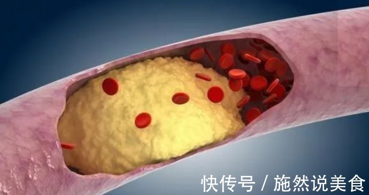 高密度脂蛋白|为何每天坚持运动锻炼,血脂就是降不下来现在知道还不算晚