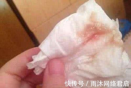 检查|女子害羞不刮毛, 忍了3年不手术, 再去医院医生说 晚了!