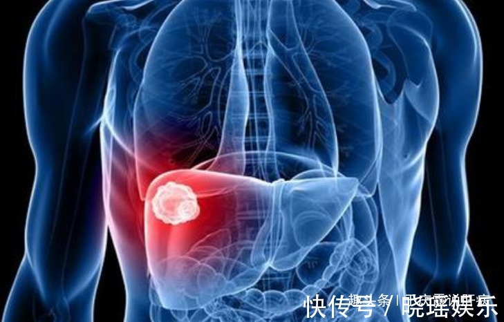 养肝护肝|泡枸杞时加一宝,肝毒跑了,远离肝硬化、肝癌,肝会跪谢你的恩德