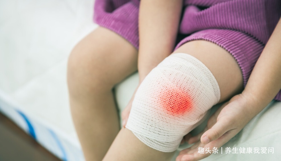 瘀血|中医说“血瘀”生百病！这些偏方定收好！调理气血不和，活血化瘀