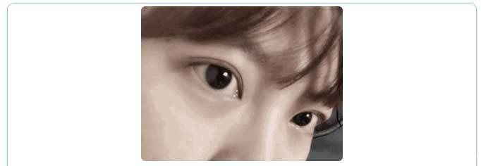 恢复|为啥割了双眼皮以后,你恢复的比别人慢