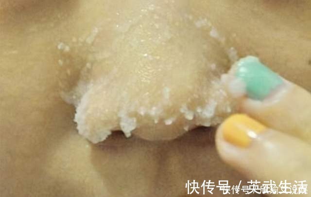 黑头|常见的4种错误的除黑头方法,奉劝:不要再用了,越除黑头越多