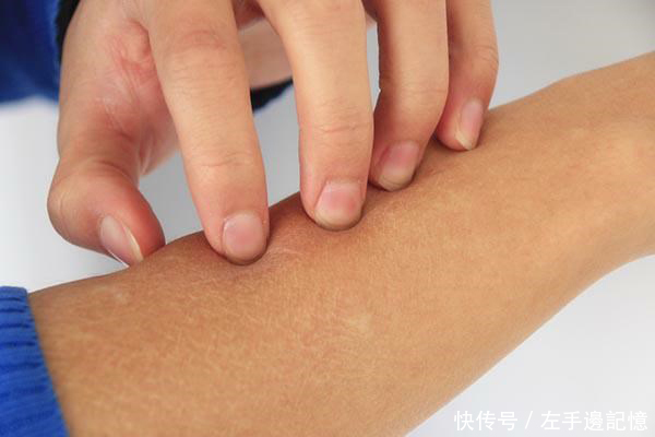 医生提醒大家,得了癌症,皮肤是会给出信号的,4点异常较为明显