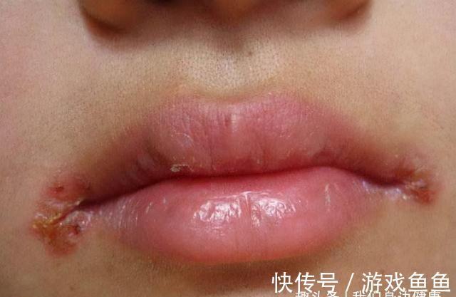 带脉|你的脾好不好?这5个特征告诉你问题出在哪里