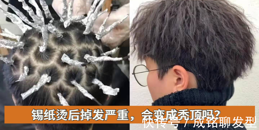 发质|烫锡纸烫后掉发严重,会变成秃顶吗?看这三点就明白掉发的原因了
