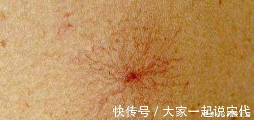 肝脏|此物是天然“解毒王”，每天常吃点，养肝排毒，肝病或不攻自破