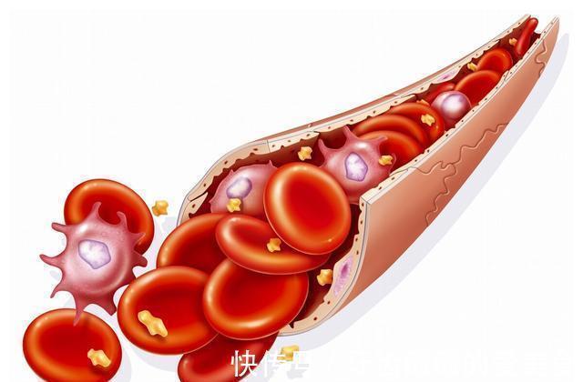 治疗|结直肠癌不能手术了?这些药物治疗可以了解一下