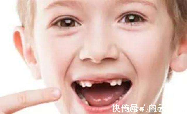 干细胞|孩子乳牙储存起来,能救命?是有条件的,家长别交智商税