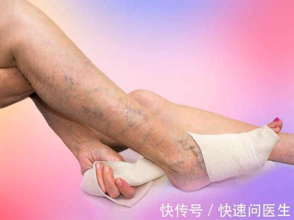 跟腱炎|跑步后脚踝疼痛是怎么回事?医生:或与这些原因有关!