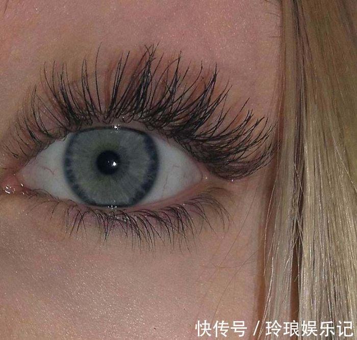 脚趾|19个“被上帝挑选过”的特殊基因人类,怎么梳都不整齐的头发