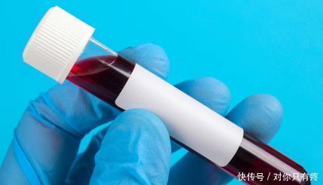 正常值|体检发现癌胚抗原升高,是怎么会事,是大肠癌吗三类人最好检查