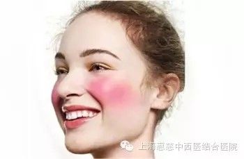 告别脸部红血丝？