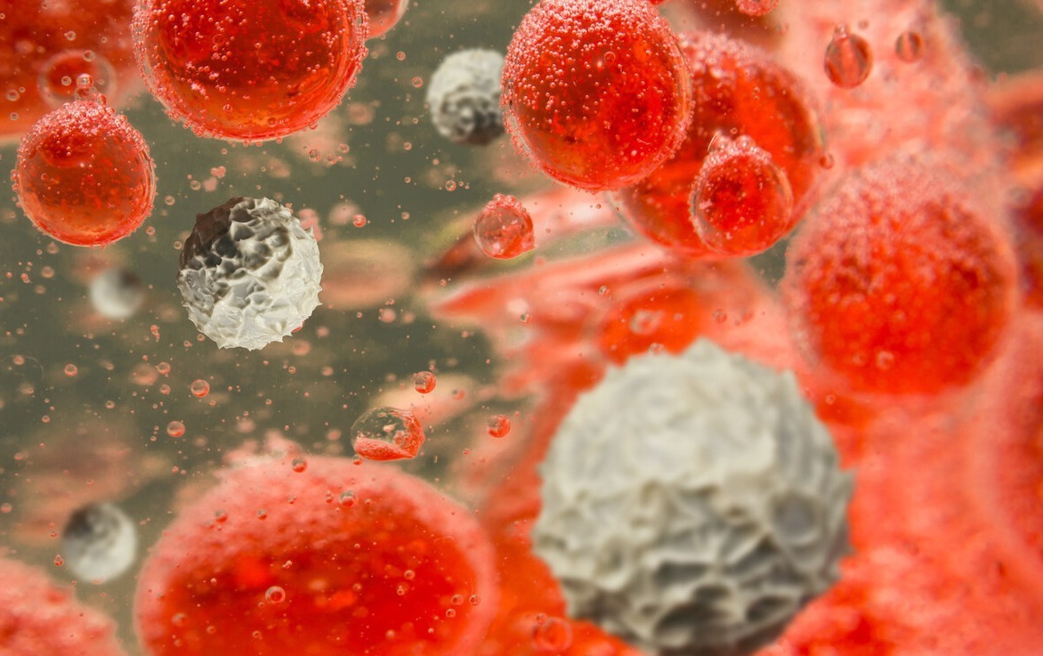 高血脂患者|降血脂的“高手”被发现了,木耳靠边,血脂降下来、血液不粘稠