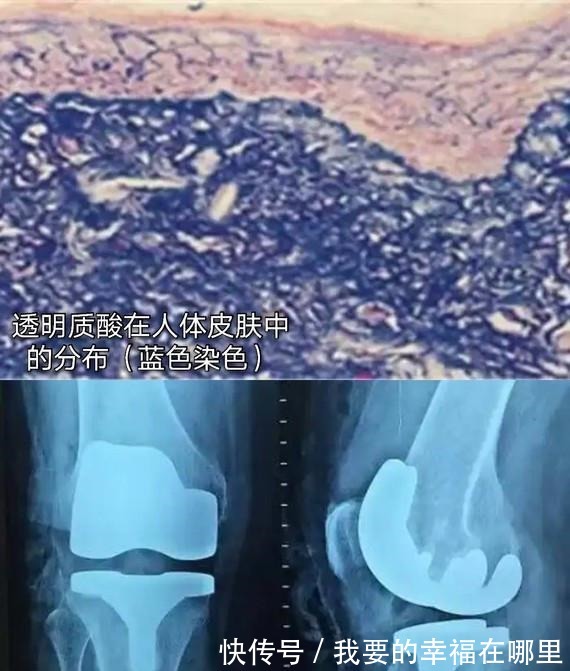 分子量 玻尿酸的前生今世!护肤、口服、医美,竟然连TT里面都有添加!