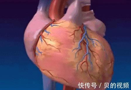 窦房结|房颤,让卒中风险高3—5倍!医生教你如何正确对待