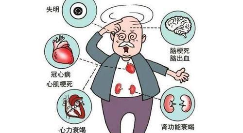 中年|这3个指标都达到了,说明老人身体还很好,实属老当益壮!